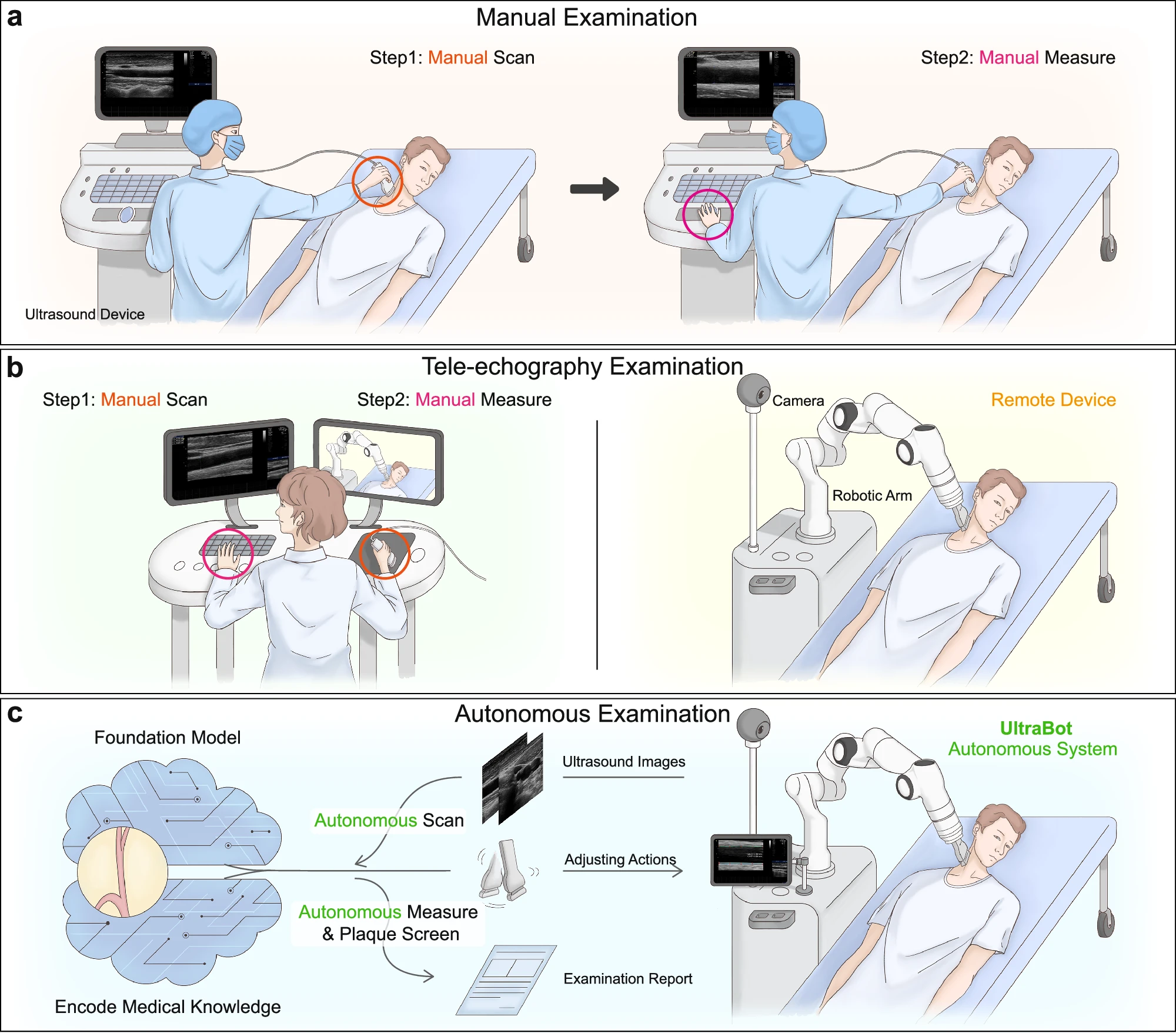 UltraBot: Towards Expert-level Autonomous Carotid Ultrasonography with Large-scale Learning-based Robotic System