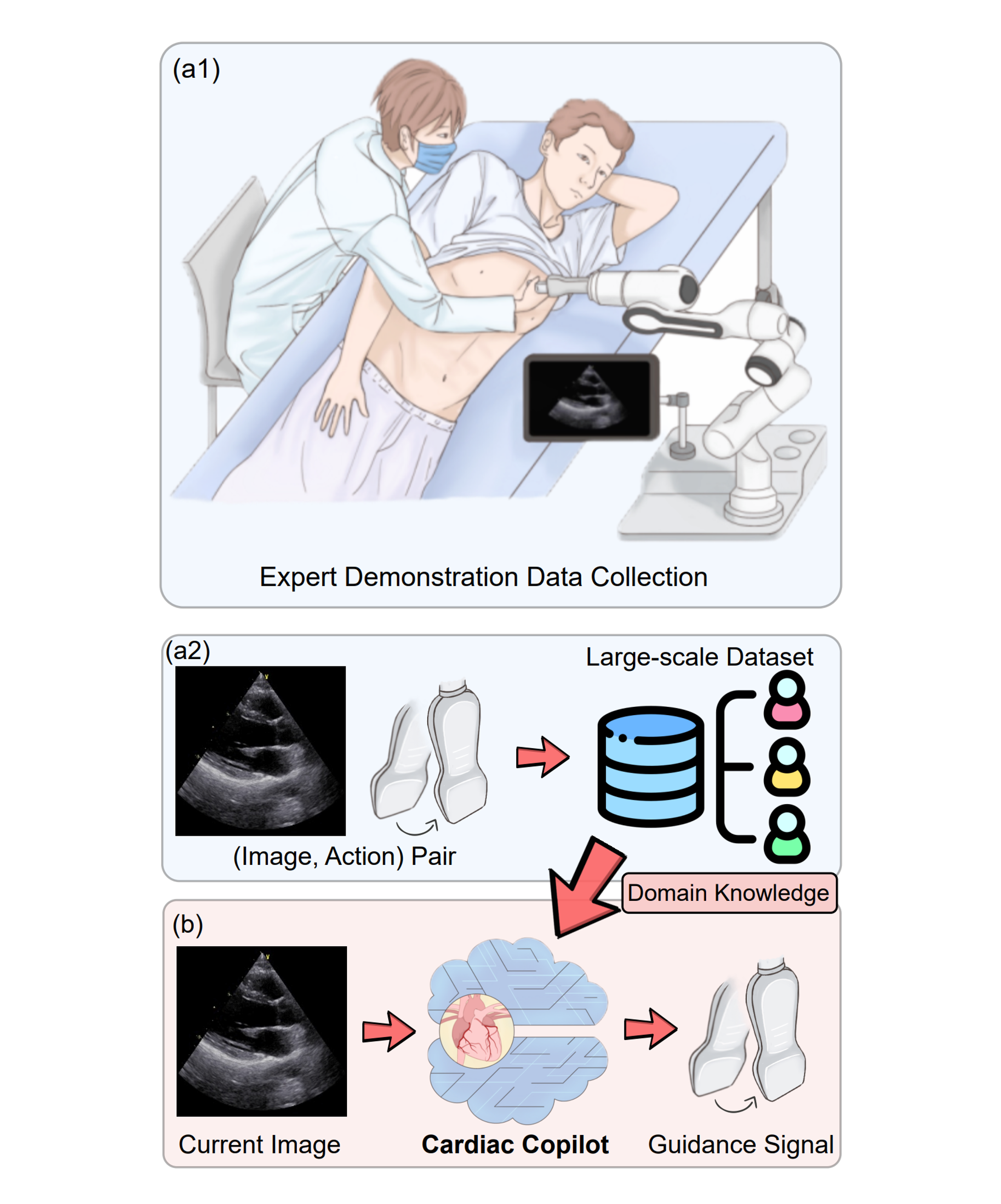 UltraCopilot: Cardiac Copilot: Automatic Probe Guidance for Echocardiography with World Model
